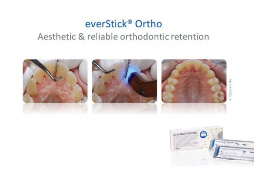 Ever Stick Ortho